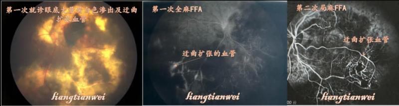 1759988425450276O6zX.png image.png