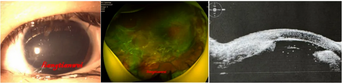 1769045604433238CU3f.png image.png