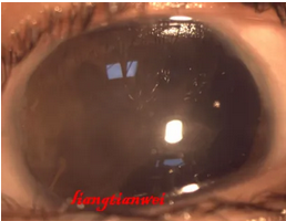 1769045638411681S7lu.png image.png